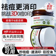 白云山祛痘膏去痘痘和痘疤青春痘學(xué)生專用皮傲寧痘印粉刺痘坑修護(hù)90g