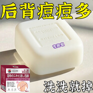 L0【凈背部痘痘】背粒消前胸后背長痘身體除螨沐浴去痘印美背手工皂 三盒裝【推薦中度螨蟲痘痘】