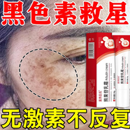 臉上黑色素沉淀去除臉部排毒排黑色素臉上黑印淡化色素沉著(zhù)結痂黑印痘印曬斑淡斑美白修復 買(mǎi)五發(fā)九盒【免費試用】多年黑色素沉淀、粗糙暗黃
