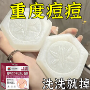 L0【凈背部痘痘】背粒消前胸后背長痘身體除螨沐浴去痘印美背手工皂 五盒裝【推薦重度螨蟲痘痘】