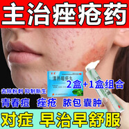 維A酸乳膏 祛粉刺痘藥膏 皮膚用藥 非處方藥青少年成人臉上長(cháng)痘痘痤瘡硬疙瘩去粉刺痘消炎專(zhuān)用藥膏 1本品+2清熱暗瘡W【高效組合 清熱解毒去粉刺痘】