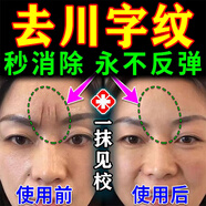 川字紋去除神器填充抬頭紋去除男女重度去皺紋去法令紋貼睡覺(jué)貼膏 【1盒賦顏抗皺嫩膚霜】