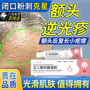 額頭痘痘閉口粉刺克星祛兒童治臉上起小疙瘩顆粒祛痘膏遮光疹 特效閉口粉刺克星額頭祛痘膏丘疹