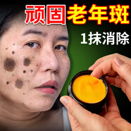祛斑霜美白淡化老年黃褐雀斑黑色素祛斑膏去老人斑膏一擦就掉強(qiáng)力除老年黑班手臉部一抹祛凈斑霜 3盒裝(中期老年斑)