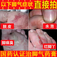 硝酸咪康唑乳膏腳氣藥止癢脫皮爛腳丫真菌感染根部治腳氣 腳氣去部根專用（發(fā)貨特效率）藥腳氣軟膏 1盒本品搭配1盒丹皮