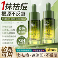 維特絲愈創(chuàng)木祛痘控油修護(hù)保濕乳液淡化痘印去痘痘收縮毛孔男女士護(hù)膚品