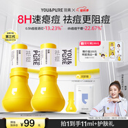 羽素祛痘大燈泡3.0 楊迪推薦 祛痘精華祛痘痘青春期去痘護膚品學(xué)生