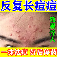 阿達帕林凝膠醫用祛痘消炎痤瘡專(zhuān)用青少年祛痘消炎痤瘡專(zhuān)用藥祛痘藥膏去痘痘和痘印臉上長(cháng)痘痘修復消炎痘印 3盒【嚴重痘痘痤瘡 一碰就疼】一抹見(jiàn)效 好后停藥