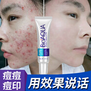 泊泉雅祛痘印淡化膏去痘痘學(xué)生女除豆豆治逗痕男士修復痘坑痘疤神器