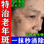 維a酸乳膏去老年斑專(zhuān)用藥一夜消去老年斑男士專(zhuān)用藥除老年黑斑臉部手背去老年斑的藥強力祛除手部臉部特藥效 5盒【嚴重反復老年斑黑色素】不留痕 好后不犯