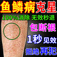 千紹方魚(yú)鱗皮膚專(zhuān)用膏藥進(jìn)口去魚(yú)鱗蛇皮雞皮膚霜全身腿部干燥脫屑身體乳 特效:買(mǎi)3送2【拒絕再犯】