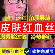 敏感肌修復(fù)面霜臉部泛紅紅血絲修復(fù)角質(zhì)層薄增厚激素紅高原紅保濕溫和無刺激舒緩紅血絲敏感肌修復(fù)面霜 [單盒體驗(yàn)裝]建議周期使用