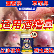 克頓默奧酒糟鼻草莓鼻紅腫玫瑰痤瘡紅鼻子專用去粉刺黑頭紅血絲螨蟲修護軟 三盒周期裝（中度型） 搭紅鼻子酒糟鼻頭紅腫產品用