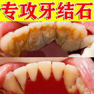 牙結石清理神器牙垢清除專(zhuān)用膏抑菌除i去i口臭口氣重嘴巴臭溶解液 【搭配購買(mǎi)有效】1盒小蘇打牙膏 去i除i口臭口氣重嘴巴臭