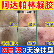 毛孔粗大修復(fù)男阿達帕林凝膠改善毛孔粗大去黑頭醫(yī)用去黑頭收縮毛孔粉刺深層清潔毛孔深層垃圾臉上出油痤瘡 五盒裝【收縮毛孔粗大】好后可停藥