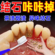 牙結石清理神器牙垢清除專(zhuān)用膏抑菌除i去i口臭口氣重嘴巴臭溶解液 搭配購買(mǎi)有效】1盒小蘇打牙膏 去i除i口臭口氣重嘴巴臭