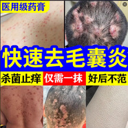 毛囊炎專用特正品效藥毛囊炎頭部專用藥頭皮癢止癢馬拉色菌手臂后背毛囊炎真菌感染皮膚用藥痘痘莫匹羅星軟膏 5盒【告別毛囊炎】直擊裉源 好后停藥