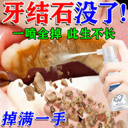 香港大藥房牙垢牙結石清除強力去溶解液清理神器牙石速效洗牙齒去黃口臭醫用 單盒裝【牙結石克星】 去祛煙漬劑牙膏噴霧