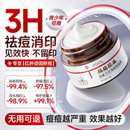 泊紫汀蘭祛痘膏祛痘淡化痘印消閉口修護(hù)痘痕痘坑去粉刺控油青春痘男女學(xué)生