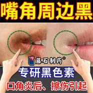 藤石制藥嘴角發(fā)黑可搭去除黑色素專用膏唇周黑嘴角黑色素沉淀去除淡化唇周黑暗沉唇紋嘴唇烏黑潤唇膏N3 2盒送棉簽 （第2盒伴價）輕度嘴角發(fā)黑