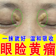 眼瞼黃瘤專(zhuān)用去除眼角黃疣眼角黃斑瘤眼部脂肪粒汗管瘤專(zhuān)用眼膏zy 單盒裝