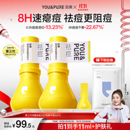 羽素祛痘大燈泡3.0 陳夢(mèng)推薦 祛痘精華祛痘痘青春期去痘護(hù)膚品學(xué)生