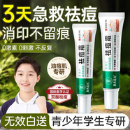 素秀臣氏祛痘膏去痘痘和青春痘痘坑修復(fù)粉刺青少年初高中生男女30g