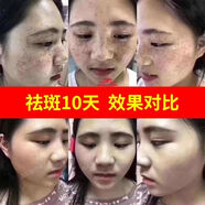 靚邦素白里透紅霜早晚淡化色斑面霜補水保濕 五合一