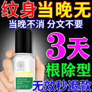 洗i紋身藥水正品去i紋身專用修復(fù)膏藥神器專用不留疤痕永久去除液 買二送一【95%顧客選擇】