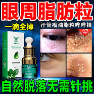 柏妮西亞（Bonixiya）脂肪粒去除藥膏汗管瘤脂肪粒去除神器眼周專(zhuān)用去小顆粒眼霜精華素 買(mǎi)二送一【三盒裝】周期裝