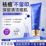 綠漾氨基酸祛痘洗面奶控油除螨蟲去黑頭男士水楊酸收縮毛孔去角質120g