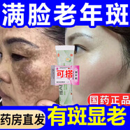 維a酸乳膏去老年斑專(zhuān)用的藥一夜臉部手背消強力祛斑專(zhuān)用霜去老人斑除黃褐雀斑黑色素男女士醫用官方正品藥膏 3盒【臉上手上都是斑很難看】最好買(mǎi)組合裝的效果產(chǎn)品
