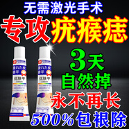 優(yōu)膚平去除疣體藥膏脖子上小肉粒藥猴子去除神器絲狀疣扁平疣專(zhuān)用脫落膏 特效:買(mǎi)2送1【疣瘊克星 一抹靈】 祛疣型克疣膏點(diǎn)痣膏疣瘊皮贅疙瘩