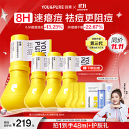 羽素祛痘大燈泡3.0 陳夢(mèng)推薦 熬夜痘姨媽痘青春痘祛痘護(hù)膚品學(xué)生痘痘