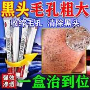 阿達帕林凝膠改善毛孔粗大去黑頭醫用祛痘消炎痤瘡專(zhuān)用青少年痘痘粉刺痘印膿包皮膚用藥深層清潔閉口毛孔堵塞 1盒【毛孔粗大粉刺黑頭】 現貨速發(fā) 非處方藥 皮膚用藥 國藥準字
