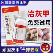 30%冰醋酸溶液灰指甲專(zhuān)用涂劑真菌感染抑菌腳部皮膚清潔角質(zhì)灰指甲抗殺菌泡腳抑菌液 買(mǎi)二發(fā)三【療程裝】試用一盒專(zhuān)注灰甲