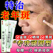 va酸乳軟膏維a酸乳膏去老年斑專(zhuān)用藥一夜祛斑消男士專(zhuān)用去除老年斑特正品效藥祛斑點(diǎn)斑專(zhuān)用藥水黃褐斑臉部手 2盒【強力祛除手部臉部班斑點(diǎn)】快速強力祛斑