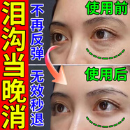 眼霜淡化細紋提拉緊致黑眼圈眼袋眼紋重度去除黑色素男女眼部沉淀 買(mǎi)二送一【去除眼底淚溝】3盒