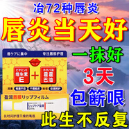 進(jìn)口唇炎專用醫(yī)用級100%慢性嘴唇干裂上火唇炎兒童醫(yī)用潤唇膏 [單支裝]一抹消