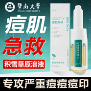BAILUHUI積雪草祛痘精華原液祛印修復痘坑粉刺閉口青少年寡肽精華液10ml