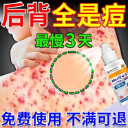 力克寧背上長痘痘毛囊除螨祛痘癢前胸后背痤瘡疙瘩皮膚炎特止癢效噴劑 買3送5【鞏固裝】告別痘痘
