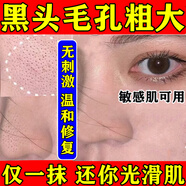 阿達(dá)帕林凝膠醫(yī)用祛痘消炎痤瘡專用青少年藥膏去痘痘和痘印閉合性粉刺藥膏臉上長痘痘修復(fù)改善毛孔粗大去黑頭 5盒【告別毛孔 還你奶油肌】