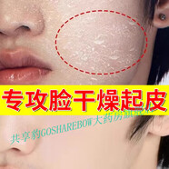 【官方旗艦】臉皮膚干燥起皮滋潤保濕面霜補(bǔ)水男女士臉上掉皮爆皮春秋冬修護(hù)霜 300ml胖東來線上超市京自東營官方旗艦店