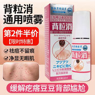 DAGO 背粒消噴霧祛痘毛囊炎去胸前硬疙瘩痘印后背部身上長(cháng)痘+潤膚脂