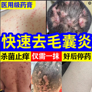 毛囊炎專(zhuān)用特正品效藥毛囊炎頭部專(zhuān)用藥頭皮癢止癢馬拉色菌手臂后背毛囊炎真菌感染皮膚用藥痘痘莫匹羅星軟膏 5盒【告別毛囊炎】直擊裉源 好后停藥
