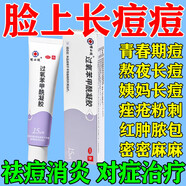 過氧苯甲酰凝膠正品祛痘消炎痤瘡專用青少年痤瘡硬疙瘩專用藥臉上祛痘痤瘡膏去青春痘印粉刺黑頭痘痘閉口專用 2+2復(fù)方珍珠暗瘡片【祛痘消炎黃金搭配】內(nèi)服外用