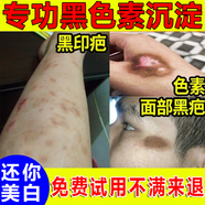 臉上黑色素沉淀去除臉部排毒排黑色素臉上黑印淡化色素沉著(zhù)結痂黑印痘印曬斑淡斑美白修復 買(mǎi)二發(fā)三【免費試用】適合輕度皮膚暗沉、有斑、有痘印