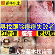 澳芙雪人參草本祛痘膏淡化青春痘霜凝膠正品粉刺痘坑痘印痤瘡專(zhuān)用 一瓶裝