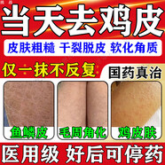 雞皮膚疙瘩毛囊角化癥專用藥國(guó)藥準(zhǔn)字去雞皮膚疙瘩毛囊角化專用去除神大腿器胳膊手臂兒童皮膚干燥水楊酸軟膏 5支裝【告別長(zhǎng)期雞皮膚】不再自卑 100%國(guó)藥 【國(guó)藥準(zhǔn)字大藥房直發(fā)】