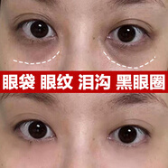 花傾美超聲刀眼霜去皺抗皺緊致淡紋去眼袋黑眼圈魚(yú)尾紋脂肪粒 5瓶針對嚴重眼紋眼袋黑眼圈